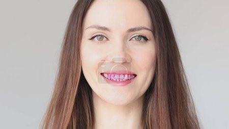 Foto de Divulgación de comprimidos para placa dental. Primer plano de los dientes de una mujer. Comprimido rosa para detectar placa bacteriana. - Imagen libre de derechos