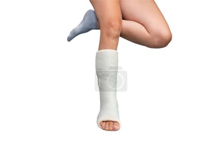 Foto de Pierna rota. Férula de tobillo y pie Vendajes en las piernas sobre fondo blanco aislado. de cerca - Imagen libre de derechos