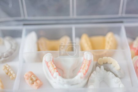 Foto de Las prótesis dentales de diferentes características, concepto de salud dental - Imagen libre de derechos