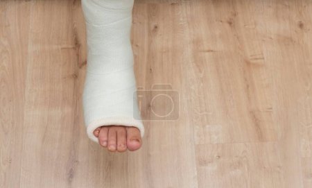 Téléchargez les photos : Une jambe cassée cheville et pied attelle bandage sur elle - en image libre de droit