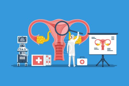 Illustration for Doctor examine uterus with magnifier. Diagnosis female reproductive system. Treatment cervical cancer, cauterize erosion. Female disease. Vector flat design. Gynecology disease prevention. - Royalty Free Image