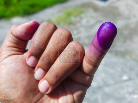 Die Hand eines Mannes, dessen Finger als Zeichen dafür eingefärbt sind, dass er seine Wahlteilnahme beendet hat