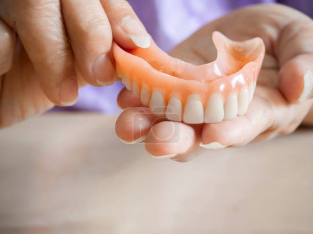An elderly woman holds a denture. A woman is holding dentures in her hands. Removable dentures flexible. False teeth. Implant. Orthodontics. Old age. Teeth. Jaw. The close plan. Removable denture