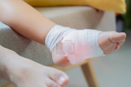 Cropped image of little boy' feet with gauze bandage. Selective focus. Kids health care concept.