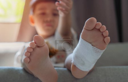 Fußschmerzen. Kleines Kind mit gebrochenem Bein sitzt nach Unfall zu Hause auf Sofa Selektiver Fokus.