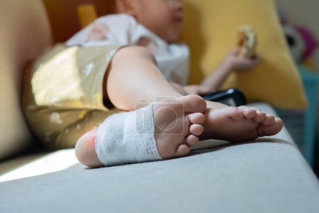 Selective focus of the injured kid's foot was treated by a doctor. Medical concept.