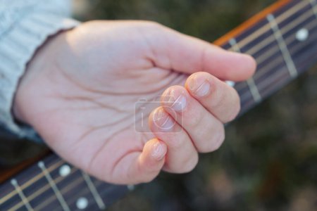 Photo for Fingers of a guitarist girl with callus prints of strings. Marks of strings on woman girl guitarist after long hours of playing - Royalty Free Image