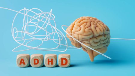 Photo for ADHD diagnosis and treatment. 3d rendering - Royalty Free Image