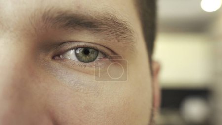 Young male eye looking into camera. Close up. Insomnia, sore eyes, disease. Slow motion