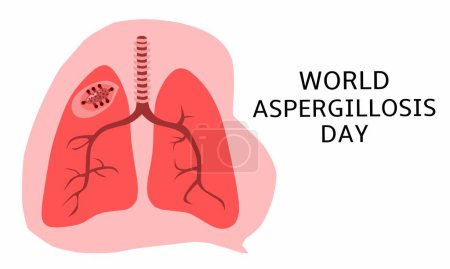 Ilustración de Vector graphic of world aspergillosis day for world aspergillosis day celebration. flat design. flyer design. February 01. - Imagen libre de derechos