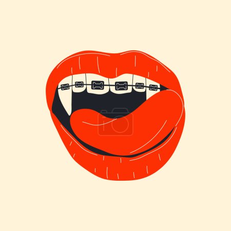 Ilustración de Boca de vampiro con tirantes y colmillos: labios rojos femeninos cerrados y abiertos con dientes caninos largos y puntiagudos - Imagen libre de derechos