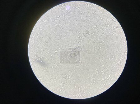 Foto de Huevos de gusano de gancho de parásito en el examen de heces. - Imagen libre de derechos