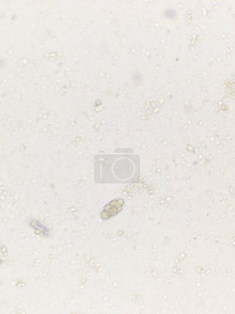 Foto de Huevos de gusano de gancho de parásito en el examen de heces. - Imagen libre de derechos