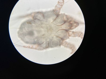 Photo for Otodectes cynotis, or ear mites under the microscope. This mites are found in cat's ear. - Royalty Free Image