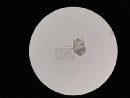 Photo for Notoedres cati under the microscope. Notoedric mange, also referred to as Feline scabies, is a highly contagious skin infestation caused by an ectoparasitic and skin burrowing mite Notoedres cati. - Royalty Free Image