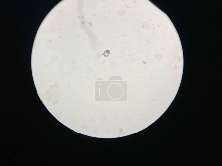 Photo for Notoedres cati under the microscope. Notoedric mange, also referred to as Feline scabies, is a highly contagious skin infestation caused by an ectoparasitic and skin burrowing mite Notoedres cati. - Royalty Free Image