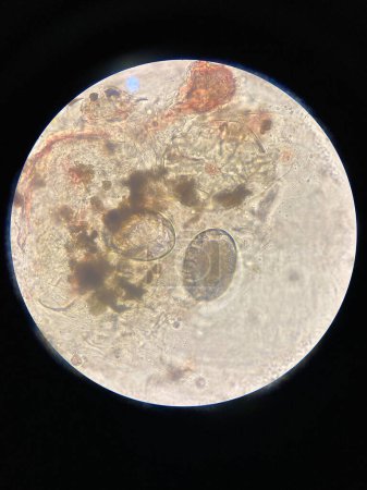 Téléchargez les photos : Scabes mites eggs, Notoedres cati, from skin sample, microscopic view. Feline scabiosis. - en image libre de droit