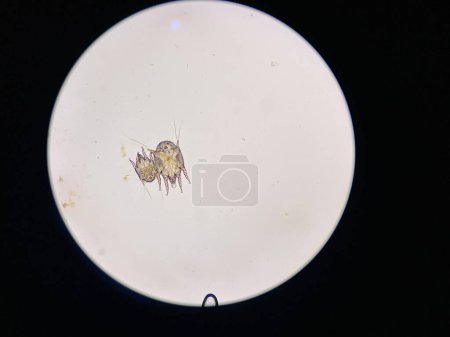 Photo for Otodectes cynotis, or ear mites under the microscope. This mites are found in cat's ear. it can causing otitis externa. - Royalty Free Image