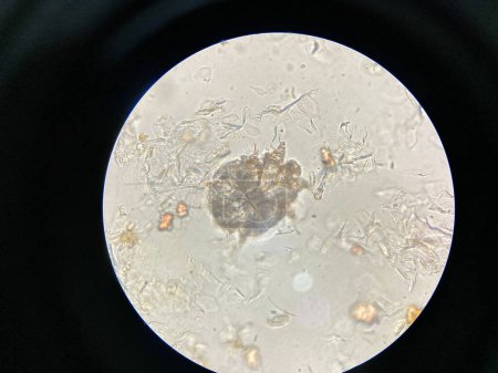 Téléchargez les photos : Notoedres cati au microscope. La gale notoédrique, également appelée gale féline, est une infestation cutanée hautement contagieuse causée par un acarien ectoparasite et fouisseur de la peau Notoedres cati. - en image libre de droit