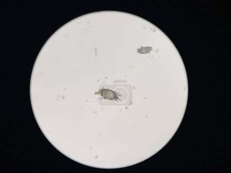 Photo for Otodectes cynotis, or ear mites under the microscope. This mites are found in cat's ear. - Royalty Free Image