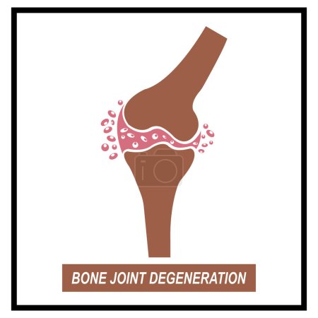 Knochengelenkdegeneration Symbol, Vektor Illustration Symboldesign