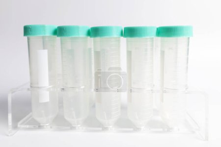 Un ensemble de tubes transparents utilisés dans des expériences scientifiques et médicales