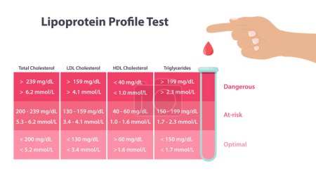 Lipoprotein Cholesterinprofil Testvektor Illustration medizinische Infografik