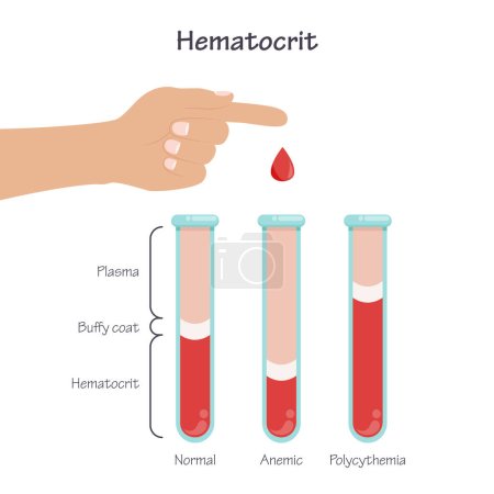 Illustration for Hematocrit blood test vector illustration medical graphic - Royalty Free Image