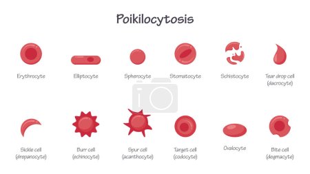 Poikilozytose Morphologie der Erythrozyten roten Blutkörperchen RBC Bildungsvektor Illustration Grafik