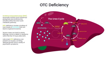 Illustration for Ornithine Transcarbamylase (OTC) Deficiency diagram vector illustration graphic - Royalty Free Image