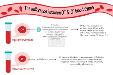 Ilustración de Ilustración vectorial de las diferencias entre los tipos de sangre O positivos y O negativos - Imagen libre de derechos