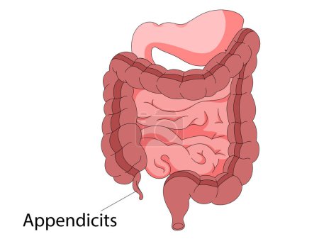 Foto de Anatomía del intestino humano. Cavidad abdominal digestiva y excreción del órgano interno. Intestino delgado y colon con recto duodeno y apéndice ilustración de digestión raster - Imagen libre de derechos