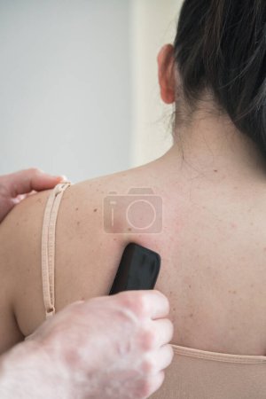 Mujer joven caucásica recibiendo tratamiento corporal. Terapeuta haciendo técnica de raspado de piel. Técnica china, gua sha, para aliviar el dolor y el tratamiento y activar la circulación sanguínea. Terapia de estímulo.