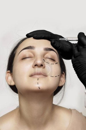 Photo for A womans face with lines drawn on her cheeks and eyebrows, being injected by a syline injection - Royalty Free Image