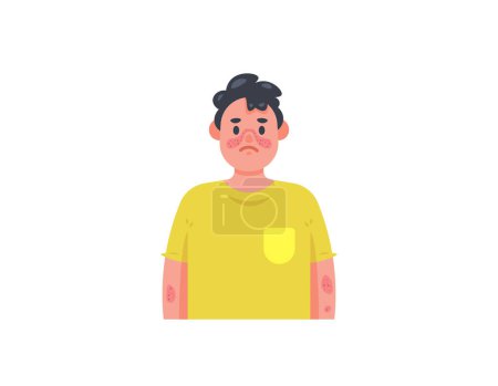 Illustration for Systemic lupus erythematosus disease. a man suffering from lupus. red rash on the face and arms. autoimmune disease. health problems. people's facial expressions. character illustration design - Royalty Free Image