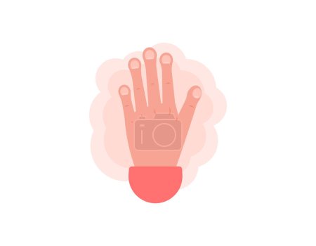 Illustration for Clubbing fingers. illustration of a hand with swollen fingertips. Swelling condition at the tip of the fingertips. disease or health problem. symbol or sign. flat style illustration design. graphic - Royalty Free Image