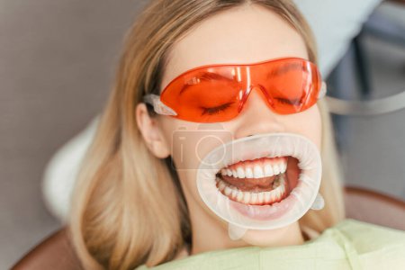 Photo for Young beautiful woman with blonde hair in red glasses with open mouth sitting in dental chair, whitening and treatment teeth. Female patient visiting dentist, checking, dental procedures - Royalty Free Image