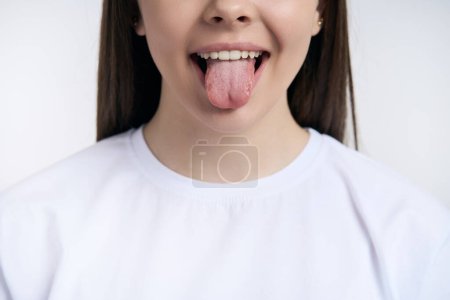 Téléchargez les photos : Vue dégagée. Visage d'une adolescente en t-shirt blanc, montrant la langue et les dents blanches propres parfaites, isolées sur fond blanc. Soins dentaires et concept d'hygiène buccodentaire. Soin des dents. Dentisterie esthétique - en image libre de droit