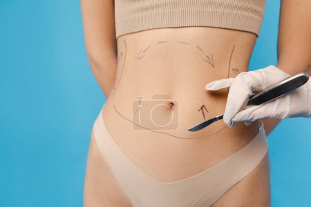 Photo for Young woman in underwear getting ready for aesthetic liposculpting treatment. Isolated on blue background. Beauty care, anti aging procedures, plastic surgery concept - Royalty Free Image
