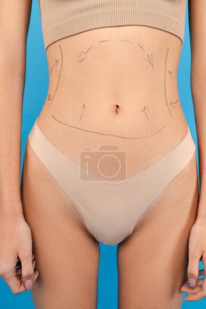 Photo for Cropped photo of female body with marks on body. Isolated on blue background. Beauty care, anti aging procedures, plastic surgery concept - Royalty Free Image