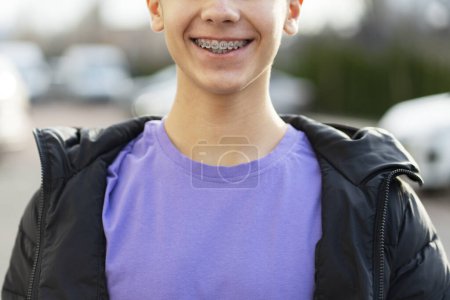 Téléchargez les photos : Portrait d'un beau garçon souriant avec des bretelles portant une tenue décontractée élégante posant sur la rue urbaine en ville, gros plan. Soins de santé, concept dentaire - en image libre de droit