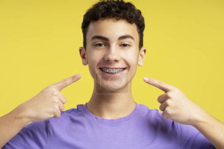 Téléchargez les photos : Adolescent confiant et souriant pointant les doigts sur les appareils dentaires en regardant la caméra isolée sur fond jaune. Soins de santé, hygiène, concept orthodontique - en image libre de droit