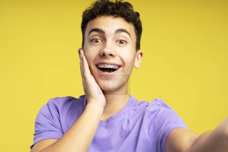 Photo for Closeup portrait smiling teenage boy wearing dental braces on teeth taking selfie isolated on yellow background. Happy modern blogger influencer recording video, communication online - Royalty Free Image