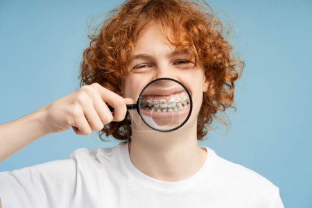 Makrofoto eines lockigen, rothaarigen Jungen mit Zahnspange, der weit lächelt und eine Lupe in der Nähe seines Mundes hält, isoliert auf blauem Grund. Betonung des zahnmedizinischen Konzepts