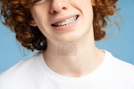 Téléchargez les photos : Portrait rapproché d'un adolescent homme aux cheveux rouges et bouclés portant un t-shirt blanc, avec un large sourire contreventé, isolé sur un fond bleu. Concept de bien-être dentaire - en image libre de droit