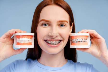 Photo for Ginger smiling woman with braces in blue shirt holding jaw models with braces and without isolated on blue background studio portrait. Healthcare procedures concept - Royalty Free Image