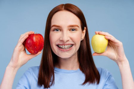 Ingwer lächelnde Frau mit Zahnspange im blauen Hemd hält zwei Äpfel in der Hand und blickt isoliert in die Kamera auf blauem Hintergrund Studioporträt. Konzept für Gesundheitsverfahren