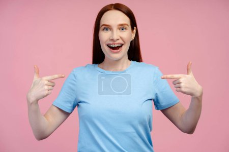 Photo for Portrait of a joyful red haired woman with braces, wearing a T shirt, confidently pointing at herself, set against a pink background - Royalty Free Image
