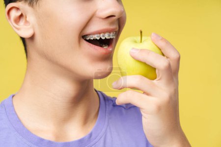 Photo for Cropped view of the curly smiling boy with braces in purple shirt holding green apple isolated on yellow background studio portrait. Healthcare procedures concept - Royalty Free Image