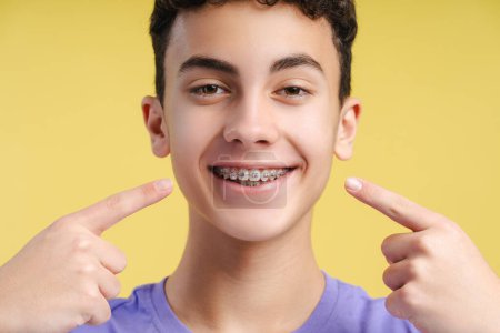 Foto de Sonriente adolescente confiado señalando los dedos en los aparatos dentales mirando a la cámara aislada en el fondo amarillo. Salud, higiene, concepto de ortodoncia - Imagen libre de derechos
